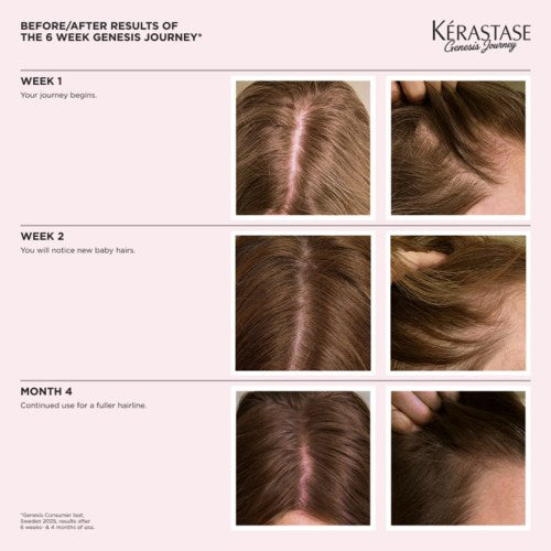 Kérastase Genesis Serum Anti-Chute Fortifiant Scalp Serum 90 ml fra Kérastase – offisielt produktbilde 10