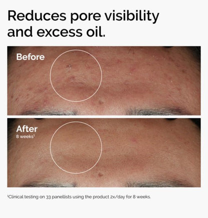 The Ordinary Niacinamide 10% + Zinc 1% 60 ml fra The Ordinary – offisielt produktbilde 3
